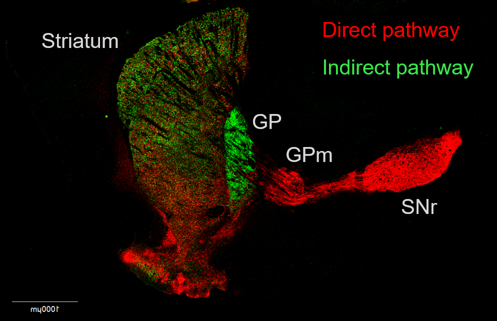 Chronic stress promotes basal ganglia disinhibition by increasing the excitatory drive of direct-pathway neurons