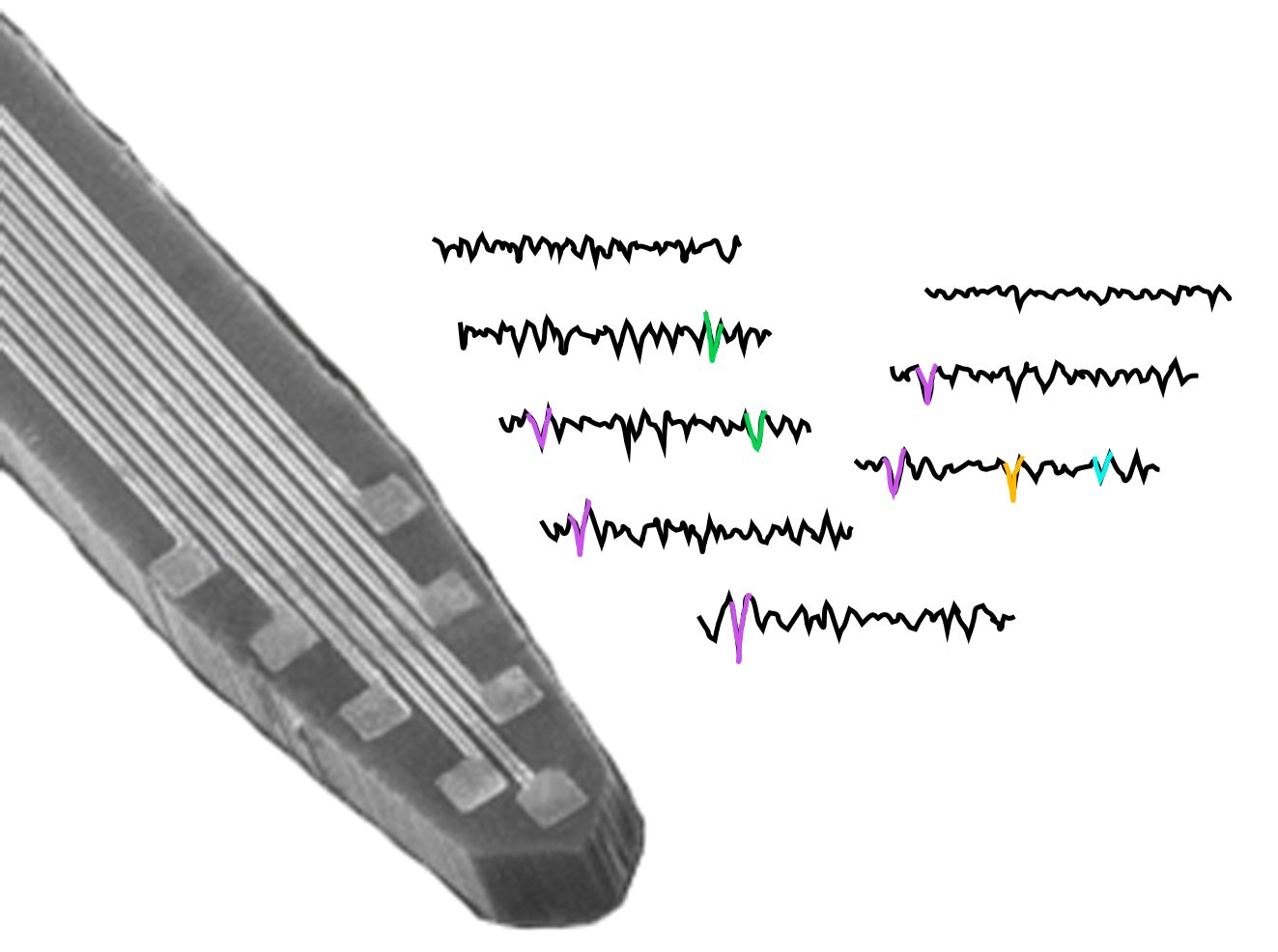 Electronic Neural Interfaces